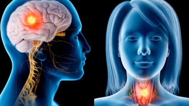 Don't Ignore These Signs Of Head And Neck Cancer - News18