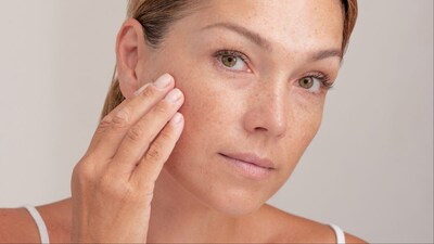 Changing weather can disrupt skin's natural balance.