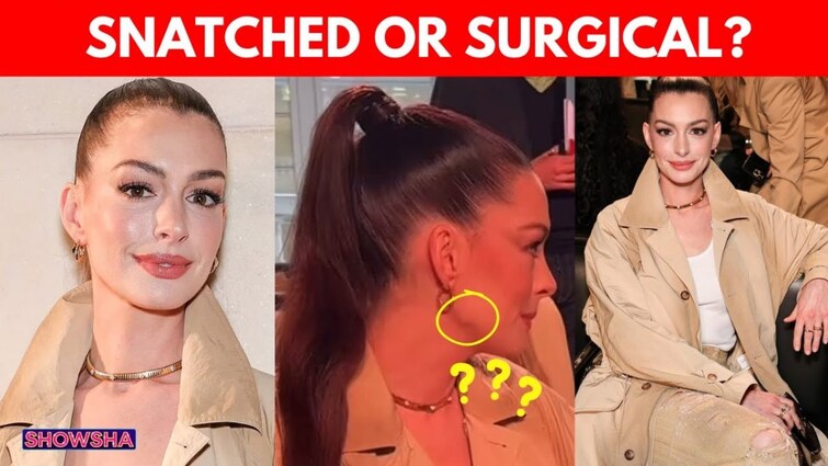 Anne Hathaway's New Look Sparks Plastic Surgery Speculation Tarnishing Her Natural Beauty Tag; N18G