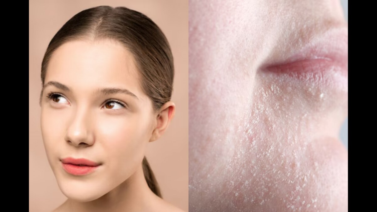 dry skin in summer
