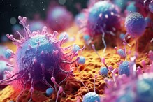 Why Ovarian Cancer Is Often Diagnosed Late And What We Can Do About It Why Ovarian Cancer Is Often Diagnosed Late And What We Can Do About It