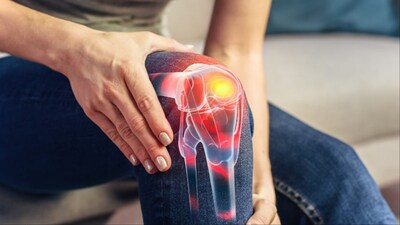 Bone burnout causes pain, stiffness, and early-onset arthritis.