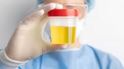 Subtle changes in the colour, consistency or odour of urine can act as early warning signs of underlying diseases. (Representative Image)