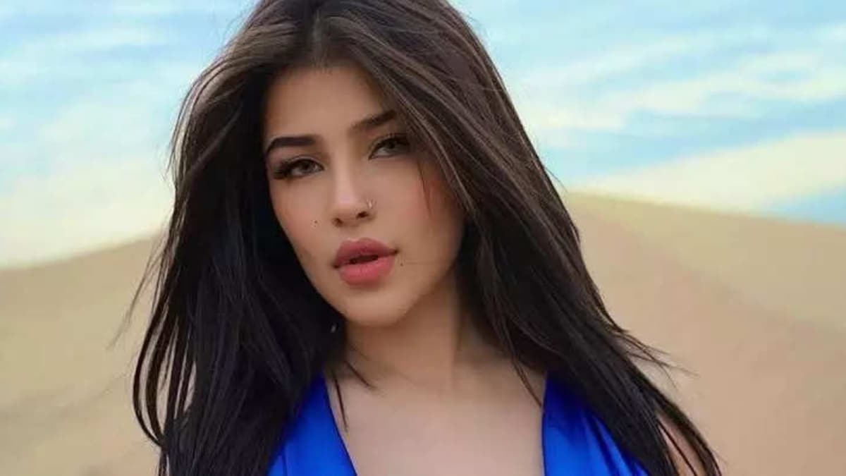 Bigg Boss 18 Fame Edin Rose On Undergoing Dimple Surgery: ‘I Own It’