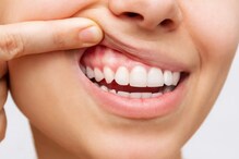 From Mouth To Heart: How Oral Bacteria May Secretly Trigger Heart Attacks