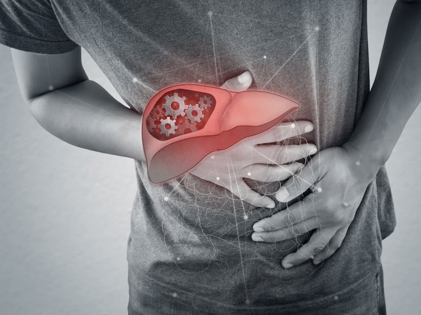 Reverse Fatty Liver Naturally: Tips From AIIMS Expert On Diet And Remedies