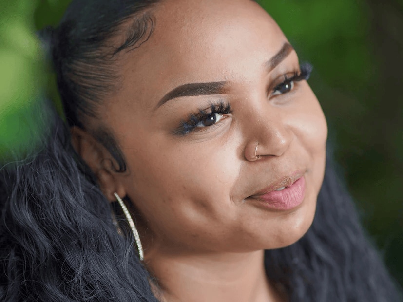 Cheek dimples are not purely cosmetic; they are connected to a muscle in the face known as the zygomaticus major. This muscle is responsible for facial expressions, especially smiling. In individuals with dimples, a variation in the structure of this muscle creates a small gap, which causes the skin above it to draw inward when they smile. Dimples are usually hereditary, meaning they run in families. (News18 Telugu) Cheek dimples are not purely cosmetic; they are connected to a muscle in the face known as the zygomaticus major. This muscle is responsible for facial expressions, especially smiling. In individuals with dimples, a variation in the structure of this muscle creates a small gap, which causes the skin above it to draw inward when they smile. Dimples are usually hereditary, meaning they run in families. (News18 Telugu)
