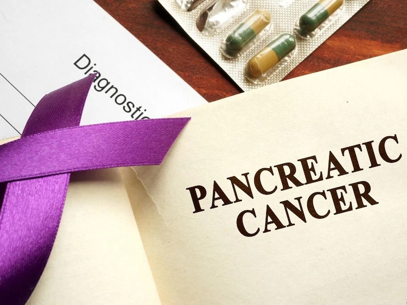 Pancreatic Cancer: Know The Four Stages, Early Symptoms, And How To ...