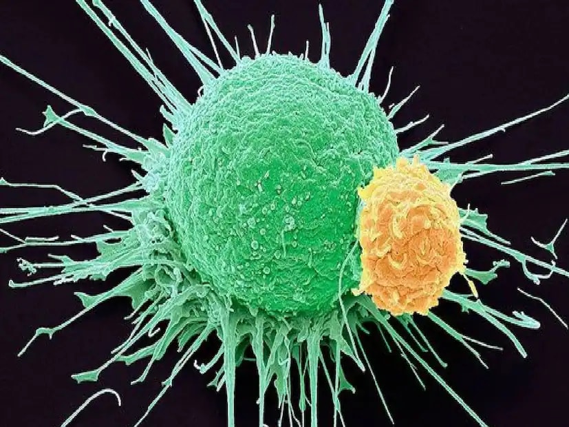 According to the World Health Organization (WHO), pancreatic cancer is among the deadliest types of cancer. It develops when abnormal cells grow uncontrollably in the pancreas. Although it is more common in older adults, men are at higher risk due to higher smoking rates. Smoking is considered the primary cause of pancreatic cancer. (News18 Telugu) According to the World Health Organization (WHO), pancreatic cancer is among the deadliest types of cancer. It develops when abnormal cells grow uncontrollably in the pancreas. Although it is more common in older adults, men are at higher risk due to higher smoking rates. Smoking is considered the primary cause of pancreatic cancer. (News18 Telugu)