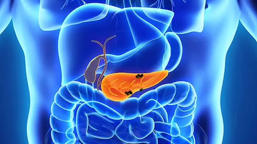 Common symptoms of pancreatic cancer include jaundice, persistent abdominal or back pain, pale or oily stools, chronic constipation, extreme fatigue, fever, liver swelling, and persistent nausea. These symptoms are often overlooked, which delays diagnosis and treatment. (News18 Telugu) Common symptoms of pancreatic cancer include jaundice, persistent abdominal or back pain, pale or oily stools, chronic constipation, extreme fatigue, fever, liver swelling, and persistent nausea. These symptoms are often overlooked, which delays diagnosis and treatment. (News18 Telugu)
