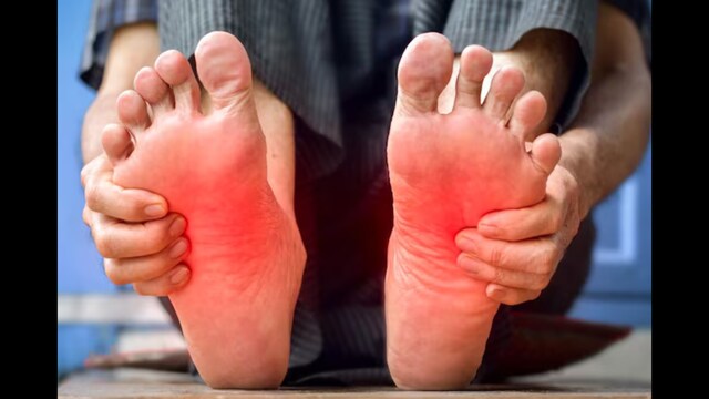Burning Sensation In Soles? It Could Be A Sign Of These 5 Health Issues |  Lifestyle News - News18