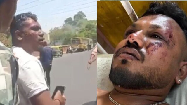 Miracle Survivor Pulled Alive From Ahmedabad Plane Wreckage, Seen Walking  To Ambulance On Camera - News18