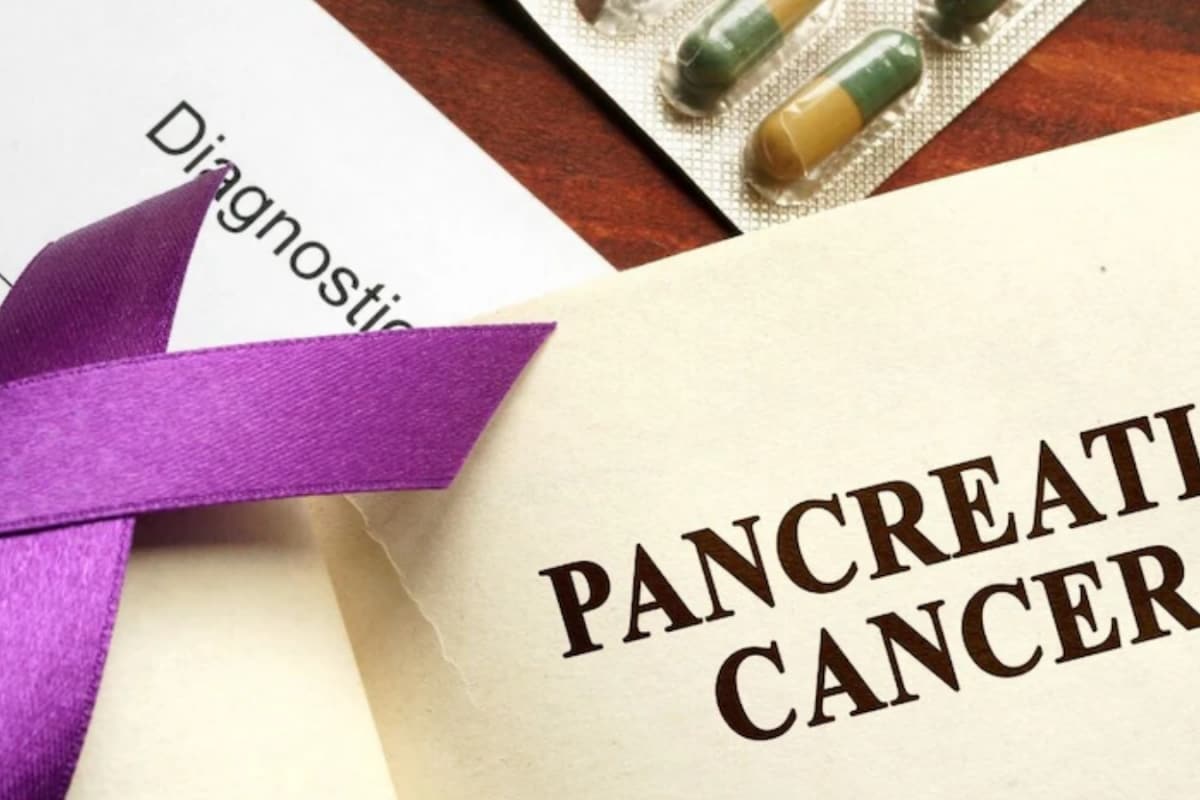 Pancreatic Cancer: Know The Four Stages, Early Symptoms, And How To Protect Yourself