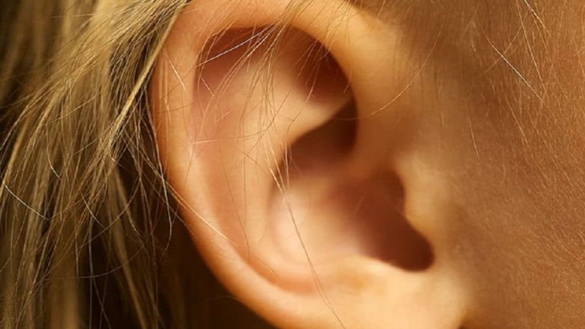 Woman Suffers 45% Hearing Loss After Using Wireless Earphones For Hours Woman Suffers 45% Hearing Loss After Using Wireless Earphones For Hours