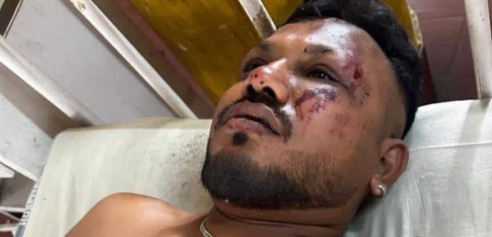 40 वर्षीय ब्रिटिश नेशनल, विश्ववश कुमार रमेश, को सीट 11 ए से बचाया गया था और वर्तमान में अहमदाबाद के पुलिस आयुक्त जीएस मलिक के अनुसार, सिविल अस्पताल, असारवा में इलाज चल रहा था। (फ़ाइल तस्वीर) 40 वर्षीय ब्रिटिश नेशनल, विश्ववश कुमार रमेश, को सीट 11 ए से बचाया गया था और वर्तमान में अहमदाबाद के पुलिस आयुक्त जीएस मलिक के अनुसार, सिविल अस्पताल, असारवा में इलाज चल रहा था। (फ़ाइल तस्वीर)