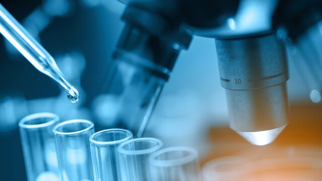 These newly discovered viruses were found in the kidneys of bats and have the potential to infect both humans and animals. (Representative/Shutterstock)