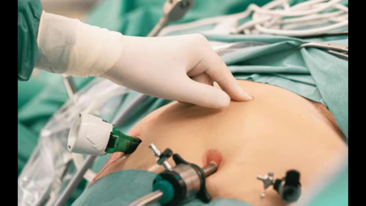 Surgical Cloth Found After C-Section in Ghaziabad Woman