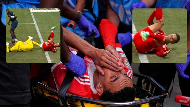 Jamal Musiala badly injured his leg (AP and X)