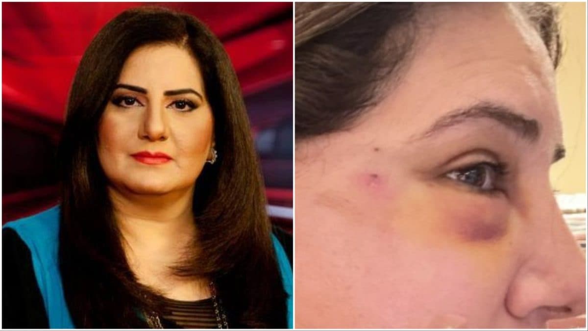 'I Have 50 More Pictures': Pakistani Anchor Alleges Assault By Ex-Husband, Posts Photos