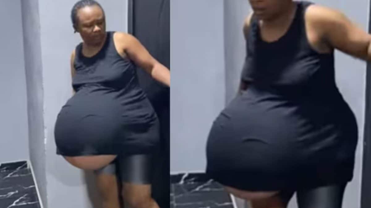 Video Of Pregnant Woman With ‘Balloon-Like Belly’ Goes Viral, Truth Is… Video Of Pregnant Woman With ‘Balloon-Like Belly’ Goes Viral, Truth Is…