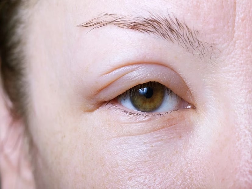 No Morning Puffiness: Many people assume morning facial puffiness is due to late nights or too much salt. While it can also be a sign that your kidneys are not filtering excess fluid and sodium effectively. (News18 Bengali) No Morning Puffiness: Many people assume morning facial puffiness is due to late nights or too much salt. While it can also be a sign that your kidneys are not filtering excess fluid and sodium effectively. (News18 Bengali)