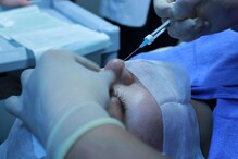 Why Skin Treatments Don’t Last Forever And How To Make Them Work For You