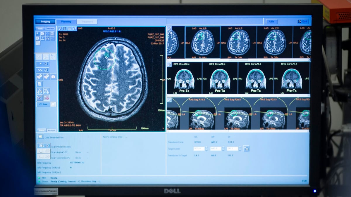 Can The Brain Really Go Blank? Doctors Shocked By Man’s ‘Empty’ Scan Can The Brain Really Go Blank? Doctors Shocked By Man’s ‘Empty’ Scan