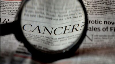 In 2024, the country recorded an estimated 15.62 lakh cancer cases, a rise from 14.6 lakh in 2022. (Representative image)