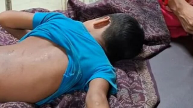Despite the severity of the incident, Shankarpur police station has not yet received an official complaint. (News18 Hindi)