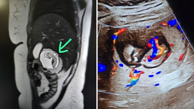 The MRI scans. (News18)