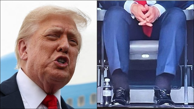 US President Donald Trump was seen with swollen ankles and bruised hands at the FIFA Club World Cup. (Reuters)