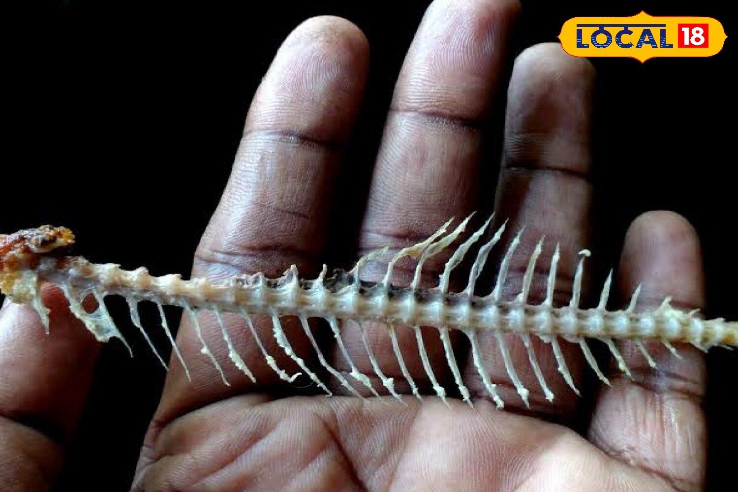Fish bones, especially tiny ones, are a common cause of throat irritation. Many people avoid eating fish due to this problem, despite its health benefits and contribution to glowing skin. Special care is advised while consuming fish with small or fine bones. (News18 Hindi) Fish bones, especially tiny ones, are a common cause of throat irritation. Many people avoid eating fish due to this problem, despite its health benefits and contribution to glowing skin. Special care is advised while consuming fish with small or fine bones. (News18 Hindi)