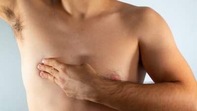 In men, breast tissue primarily consists of fatty tissue with a few ducts and stroma, but it can still develop the same types of cancers, the most common being invasive ductal carcinoma