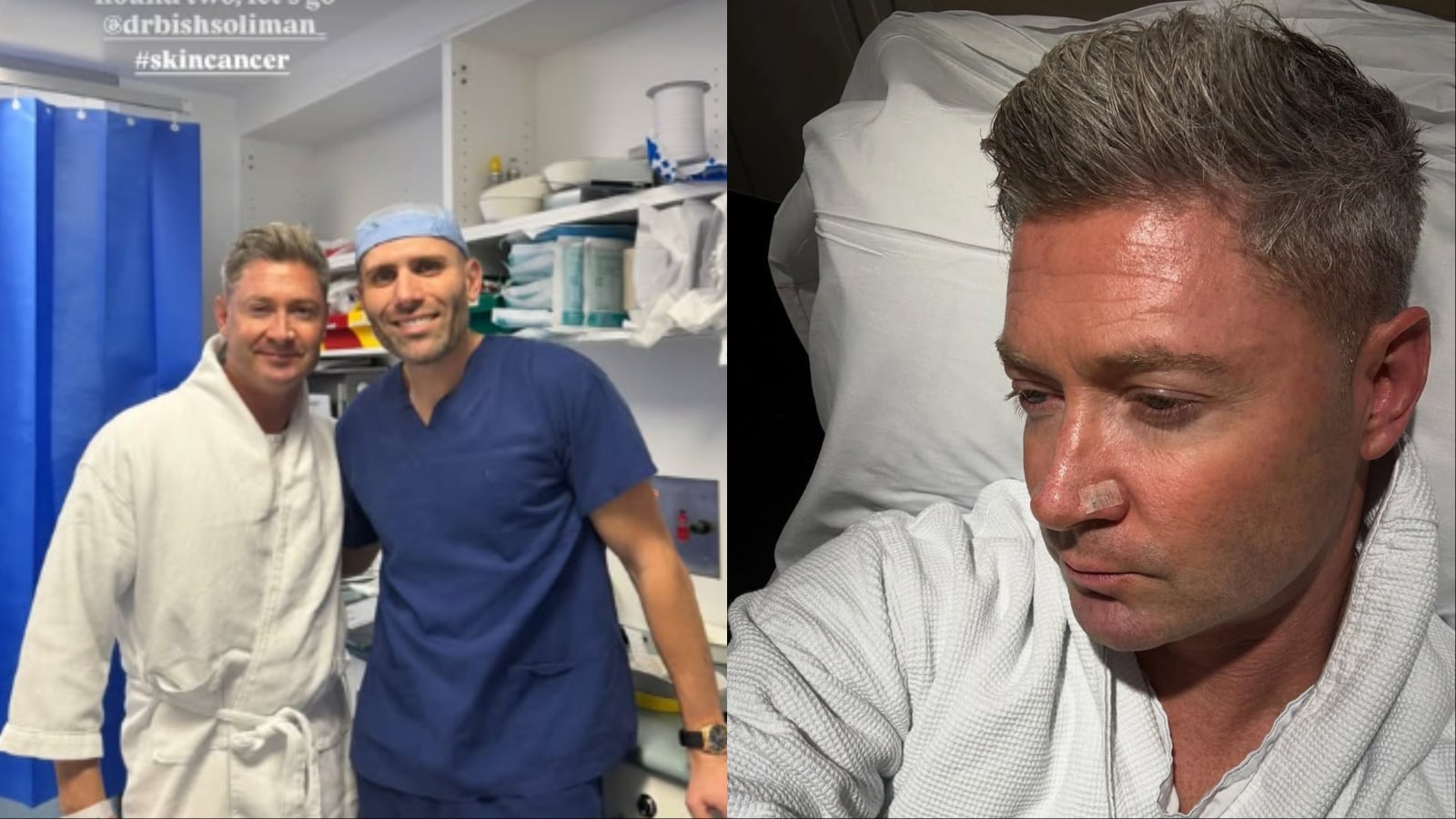 Michael Clarke Revela Batalha Contra Câncer de Pele e Alerta Sobre a Saúde: 'Já Tirei Sete do Rosto!'