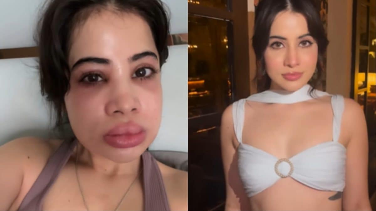 Uorfi Javed Shares Painful Dissolving Process, Shares Natural Looks In New Video | Lifestyle News