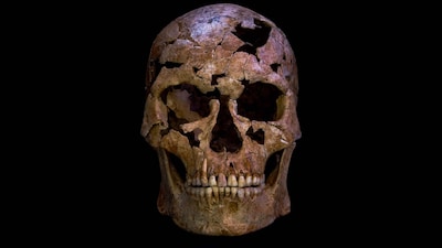 The skull and skeleton of the man from the Thung Binh 1 cave are arranged in their anatomical positions. (CNN)