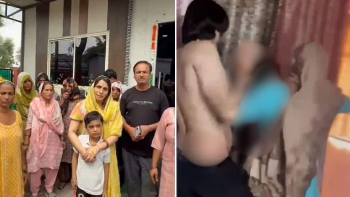 ‘They Slapped Mumma, Then Set Her On Fire’: Noida Boy Describes Mother’s Dowry Death