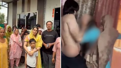 The deceased, identified as Nikki, had married into a family in Greater Noida’s Sirsa village in 2016. (X)