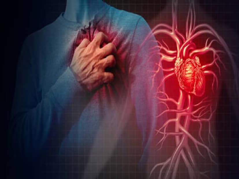 A heart attack is a medical emergency that occurs when the blood supply to the heart is suddenly blocked. Medically known as myocardial infarction, this condition affects around 805,000 people in the United States every year, meaning one person suffers a heart attack every 40 seconds. (News18 Bengali) A heart attack is a medical emergency that occurs when the blood supply to the heart is suddenly blocked. Medically known as myocardial infarction, this condition affects around 805,000 people in the United States every year, meaning one person suffers a heart attack every 40 seconds. (News18 Bengali)