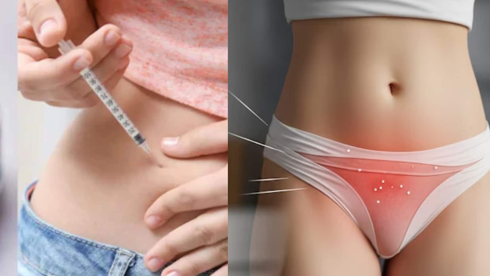 What Is 'Ozempic Vulva'? Women Using Weight-Loss Drugs Are Reporting Vaginal  Side Effect | Health and Fitness News - News18