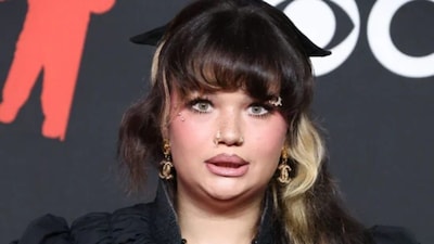 Singer Lola Young Collapses During NYC Festival, Gives Health Update