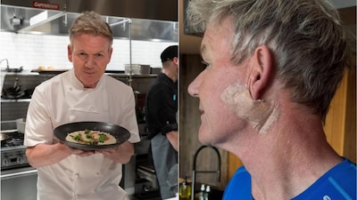 Gordon Ramsay reveals skin cancer surgery, urges sunscreen protection