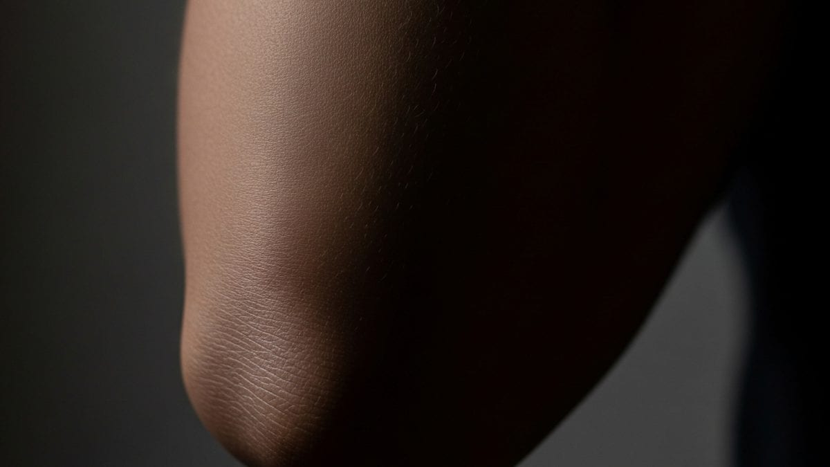 <div>Here's How To Get Rid Of Dark Elbows And Knees With Kitchen Ingredients</div>