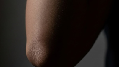 Constant friction, dryness, and sun exposure often make these areas look rough and darker than the rest of your skin. (AI Generated Image)