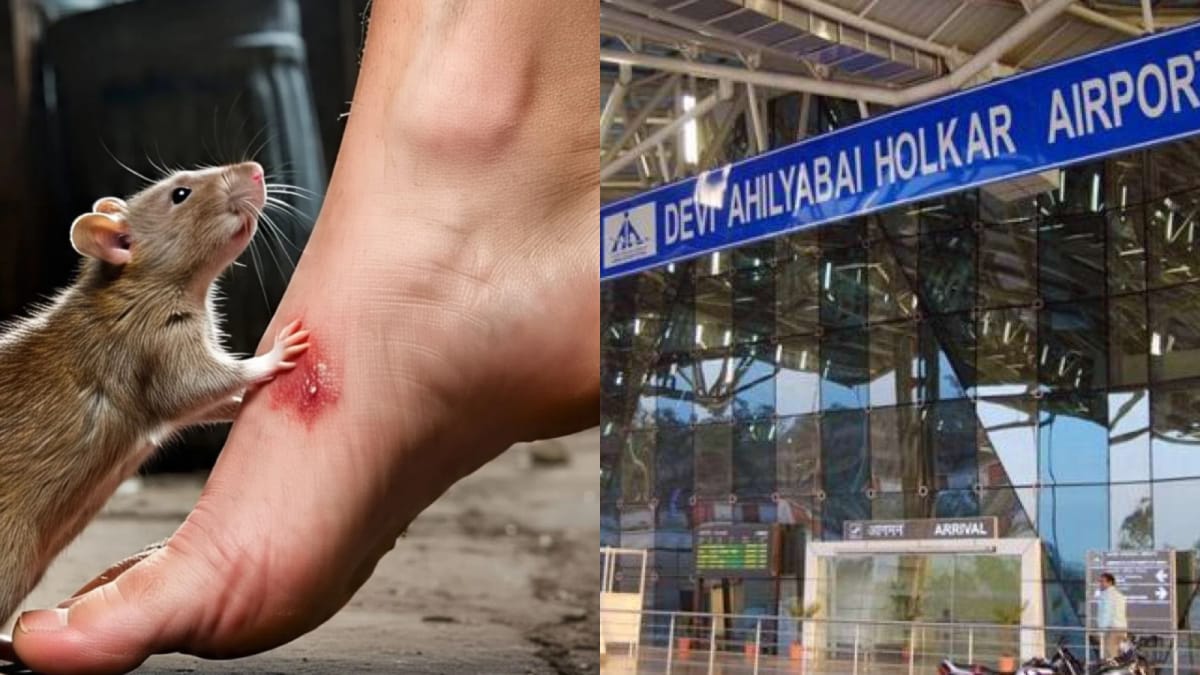 Rat Slips Into Passenger’s Pants, Bites Him Near Knee At Indore Airport