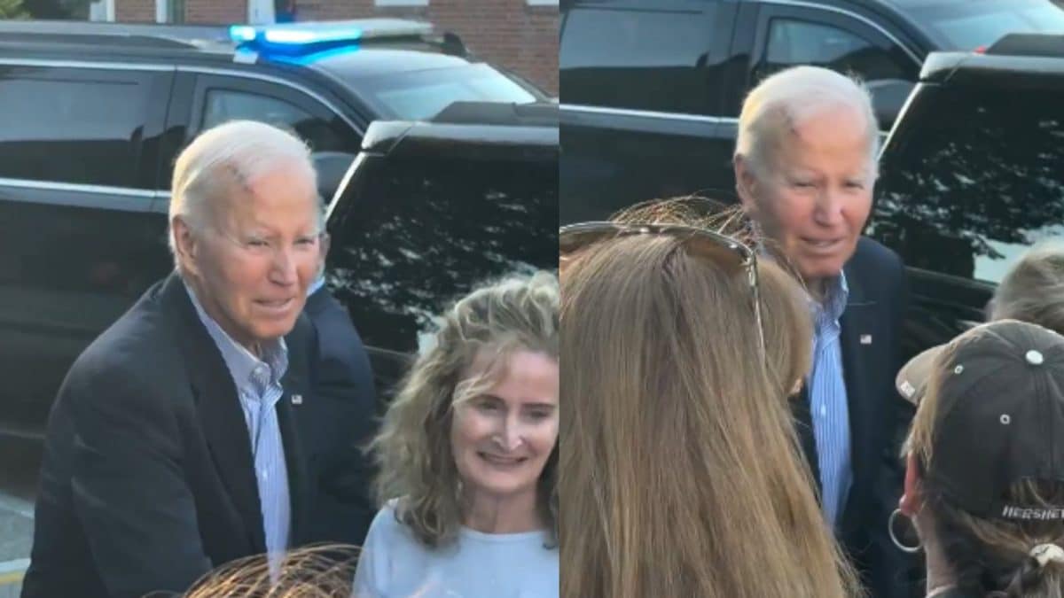 Joe Biden Spotted With Huge Scar On Forehead, Spokesperson Shares Reason