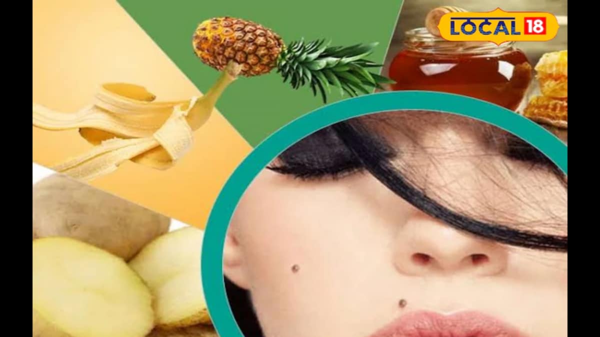 <div>Tips & Tricks: Remove Moles Safely At Home With Coconut Oil, Garlic, Honey And Potato</div>