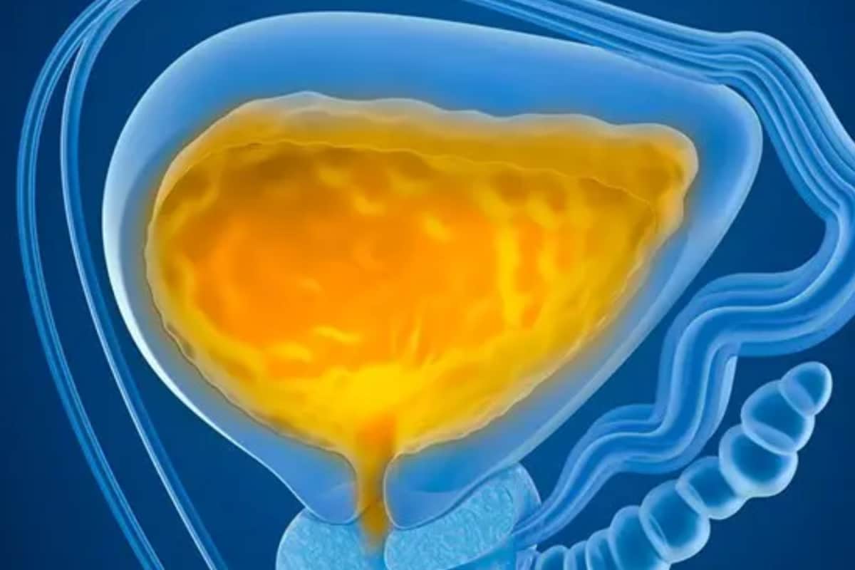 Cloudy Urine: Common Causes And What It Could Mean For Your Health