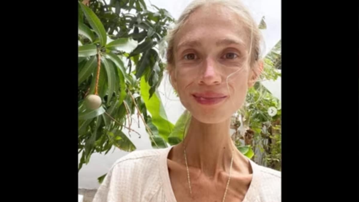 Cutting Out Protein? Woman Dies Of Starvation In Bali After Extreme Fruit-Only Diet
