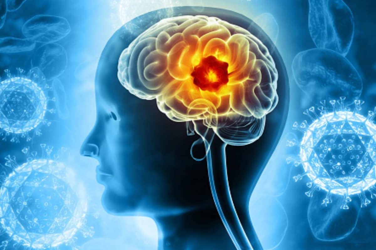 What To Know About Brain Tumour, How It Affects Patients, And Are There Early Signs To Detect It?